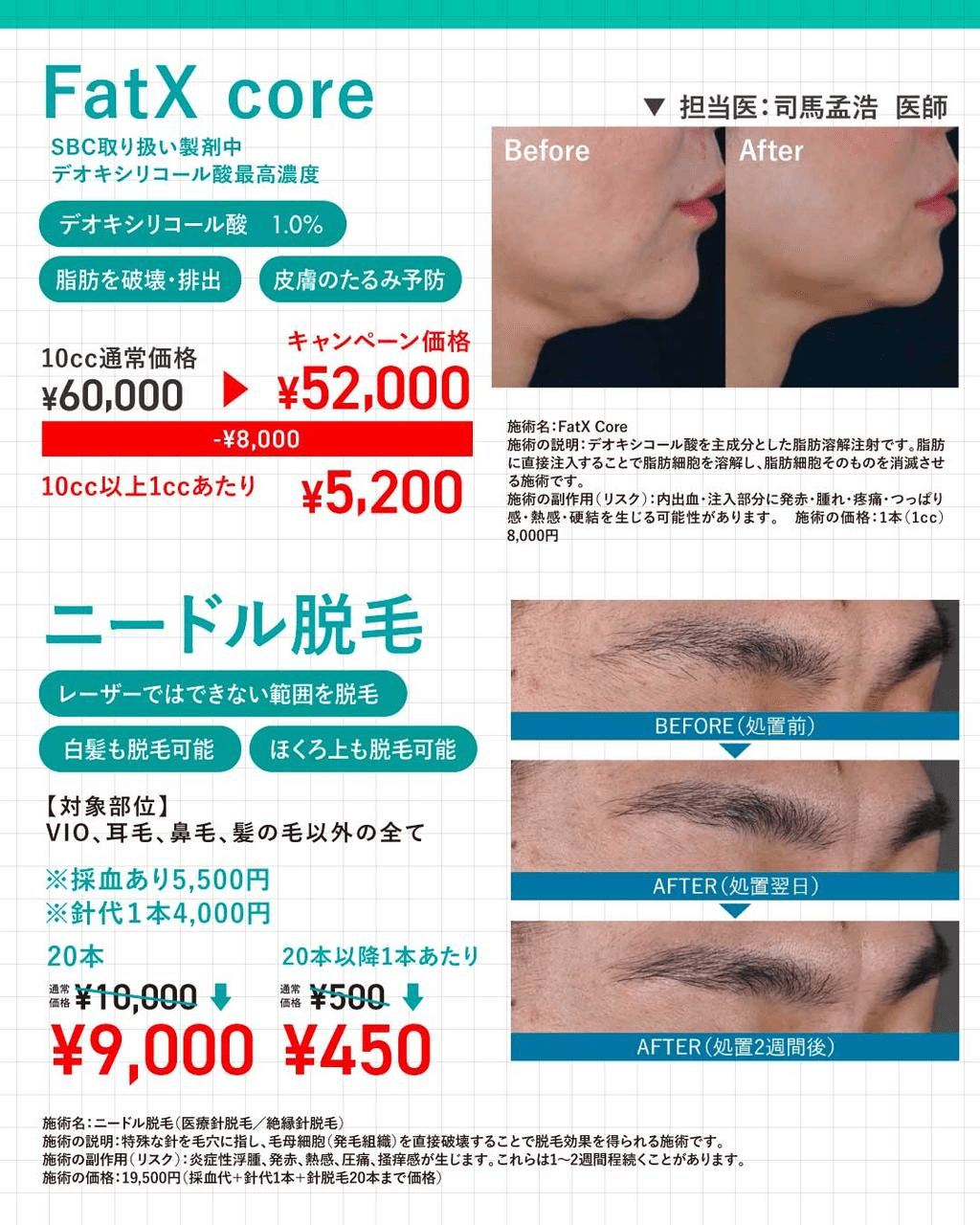 5月のキャンペーン✨-photo2