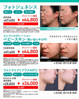 5月のキャンペーン✨_01-small-photo4